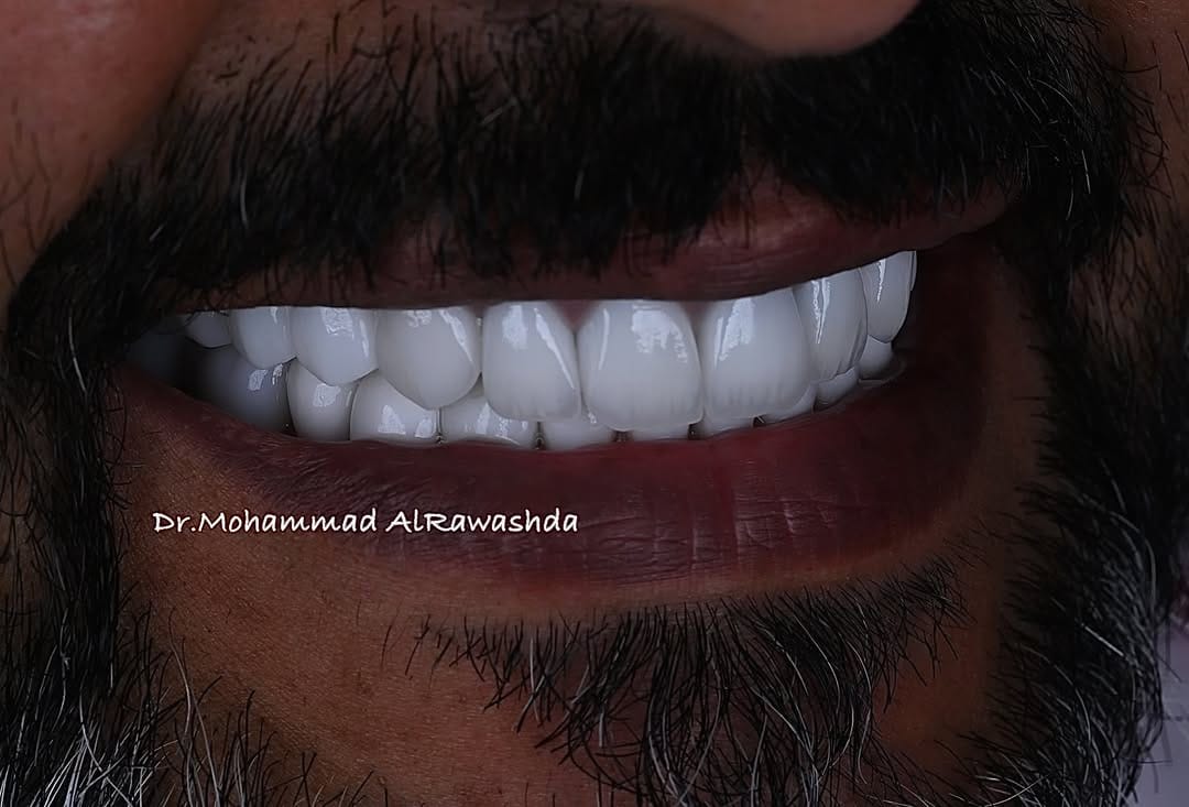 Post 4 by Mohammad Faisal on Instagram (image)