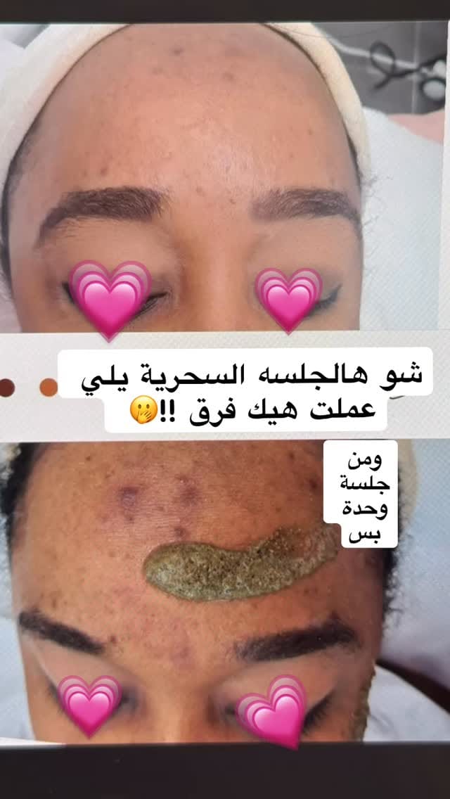 Post 2 by Ruby Kosmetik Akademie  مركز تجميل وتدريب on Instagram (video)