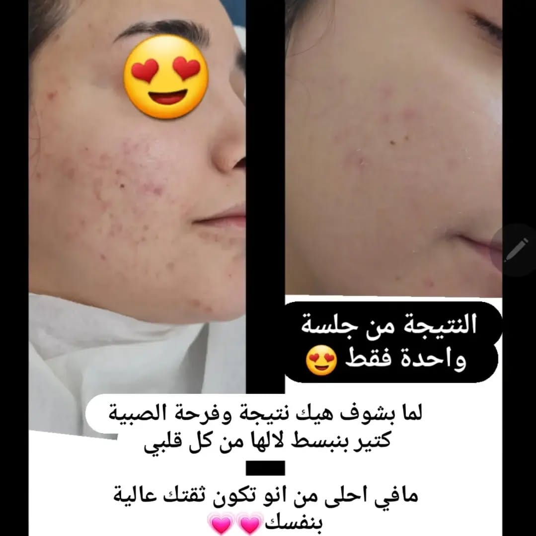 Post 9 by Ruby Kosmetik Akademie  مركز تجميل وتدريب on Instagram (image)