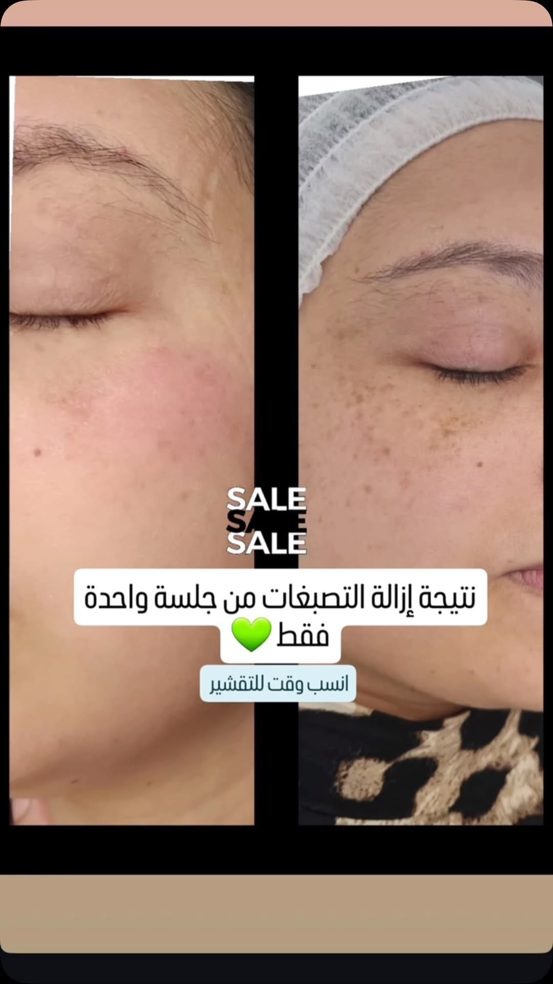 Post 4 by Ruby Kosmetik Akademie  مركز تجميل وتدريب on Instagram (video)
