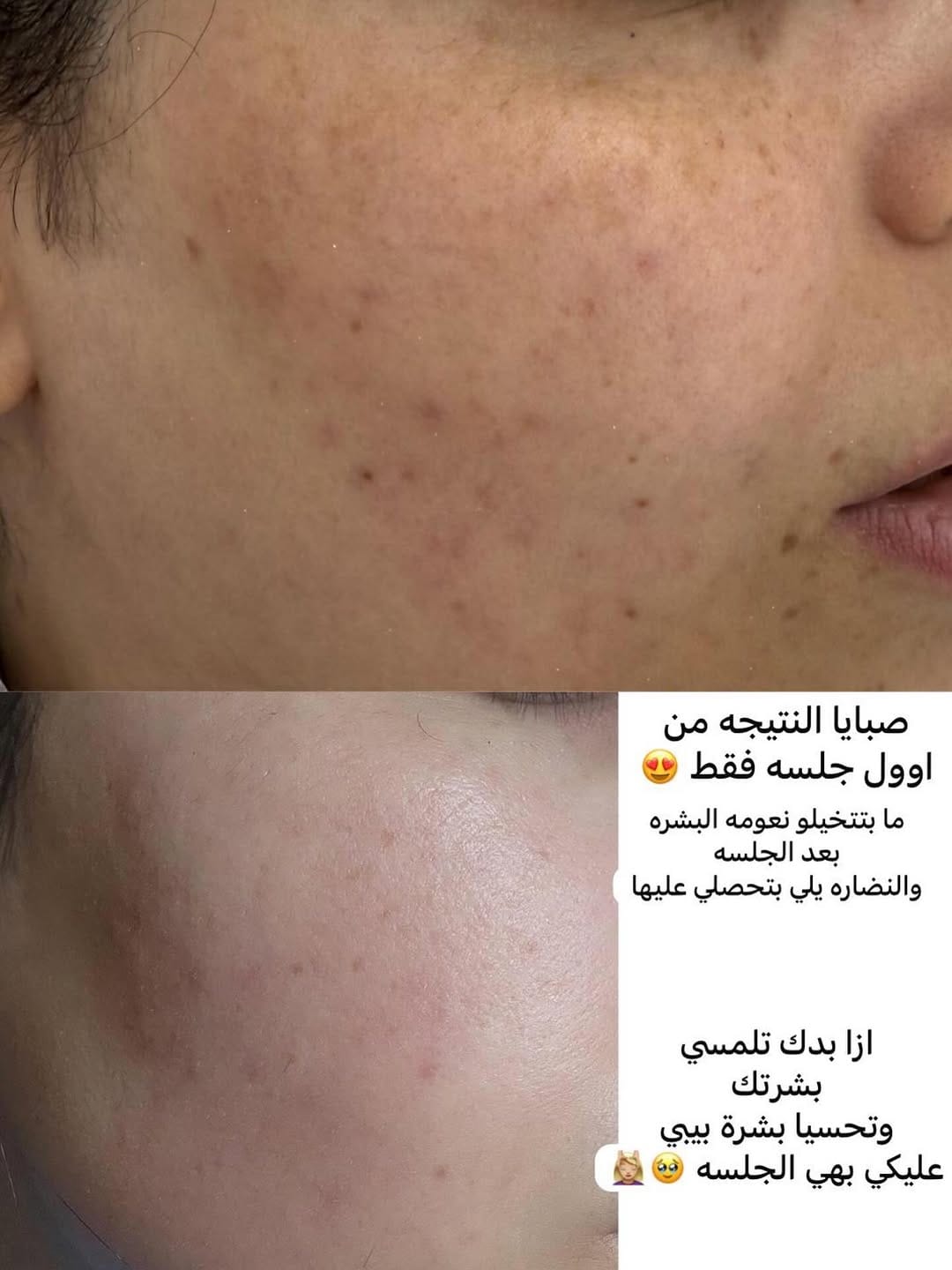Post 3 by Ruby Kosmetik Akademie  مركز تجميل وتدريب on Instagram (image)