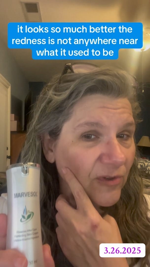 Post 5 by Rosacea Skincare Products on Instagram (video)