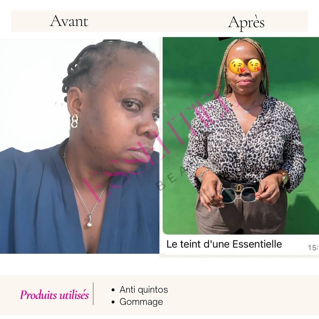 Post 8 by ESSENTIEL  BEAUTY 🇫🇷 on Instagram (image)