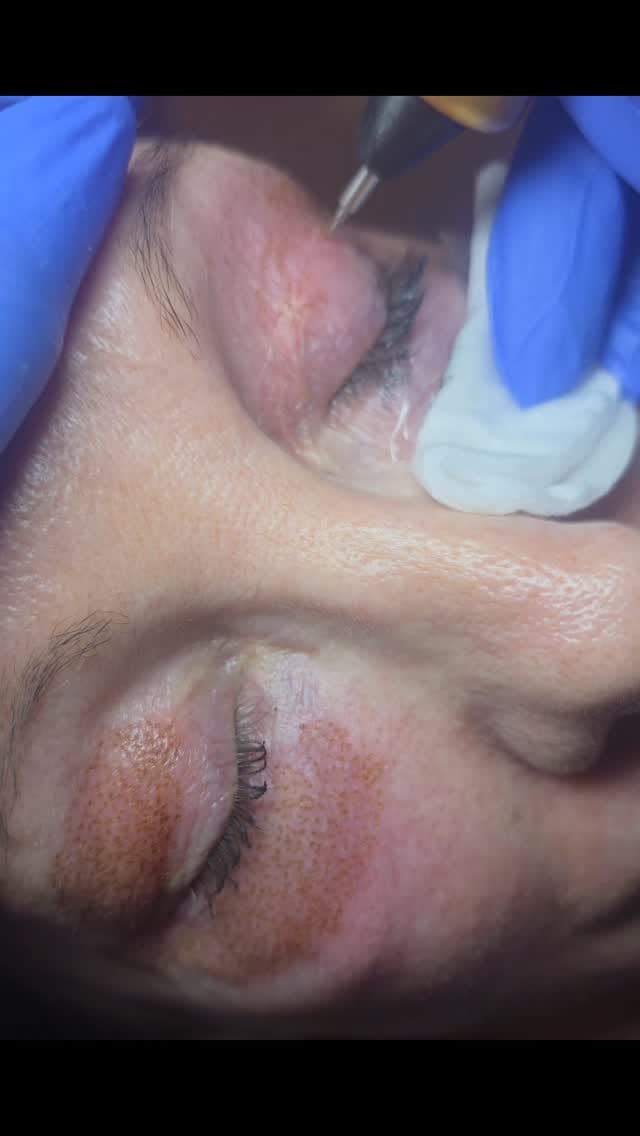 Post 1 by Fave Ästhetik - Kosmetikstudio Berlin on Instagram (video)