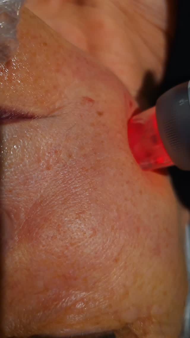 Post 4 by Fave Ästhetik - Kosmetikstudio Berlin on Instagram (video)