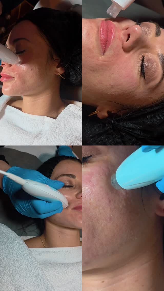 Post 9 by Fave Ästhetik - Kosmetikstudio Berlin on Instagram (video)
