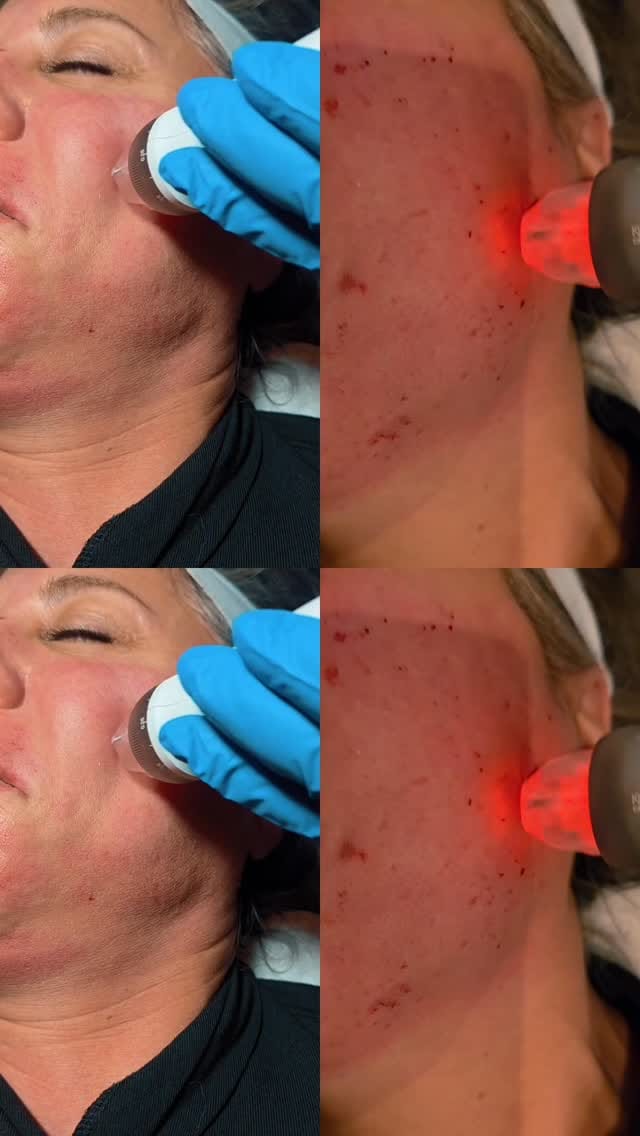 Post 3 by Fave Ästhetik - Kosmetikstudio Berlin on Instagram (video)