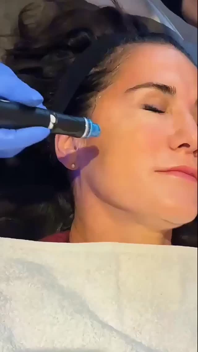 Post 7 by Fave Ästhetik - Kosmetikstudio Berlin on Instagram (video)