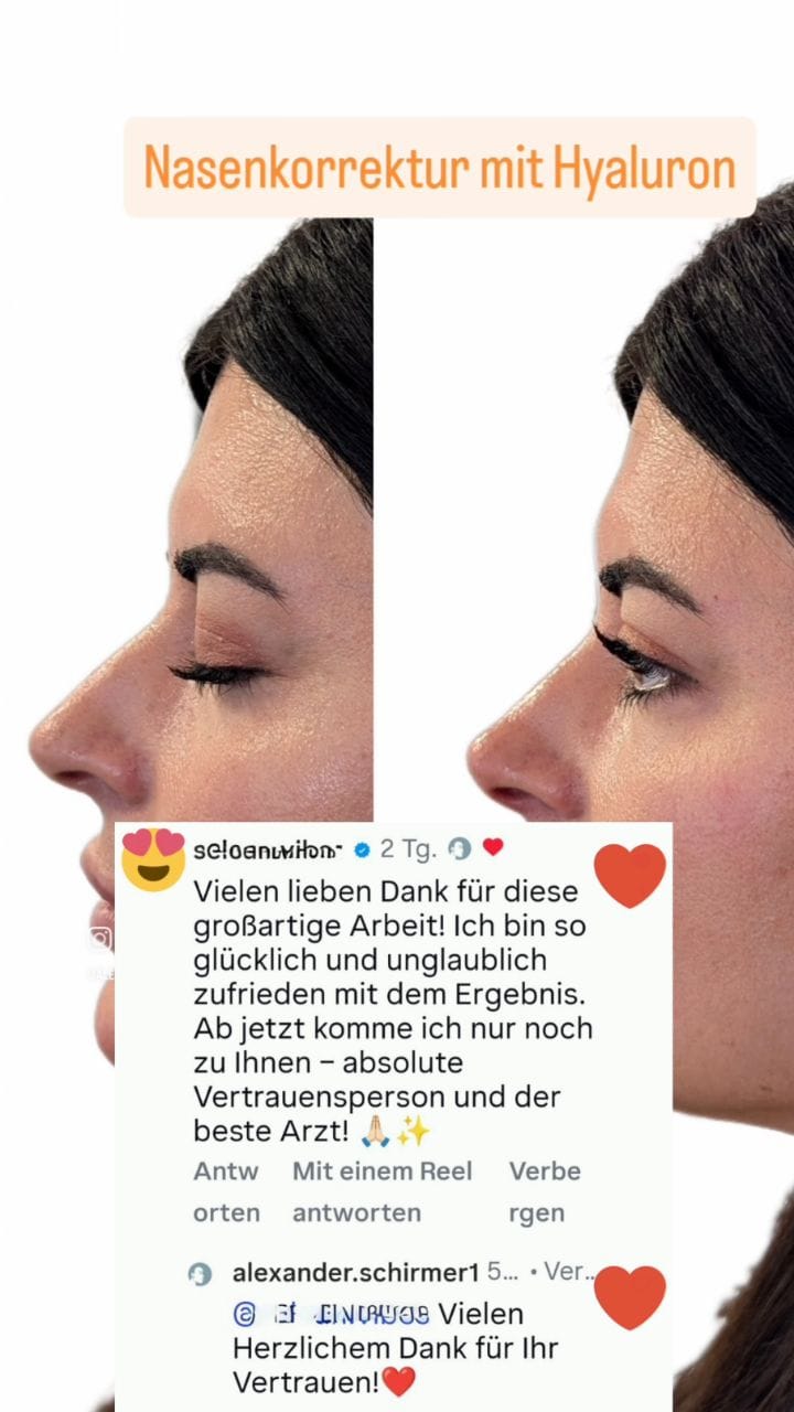 Post 3 by Alexander Schirmer on Instagram (video)