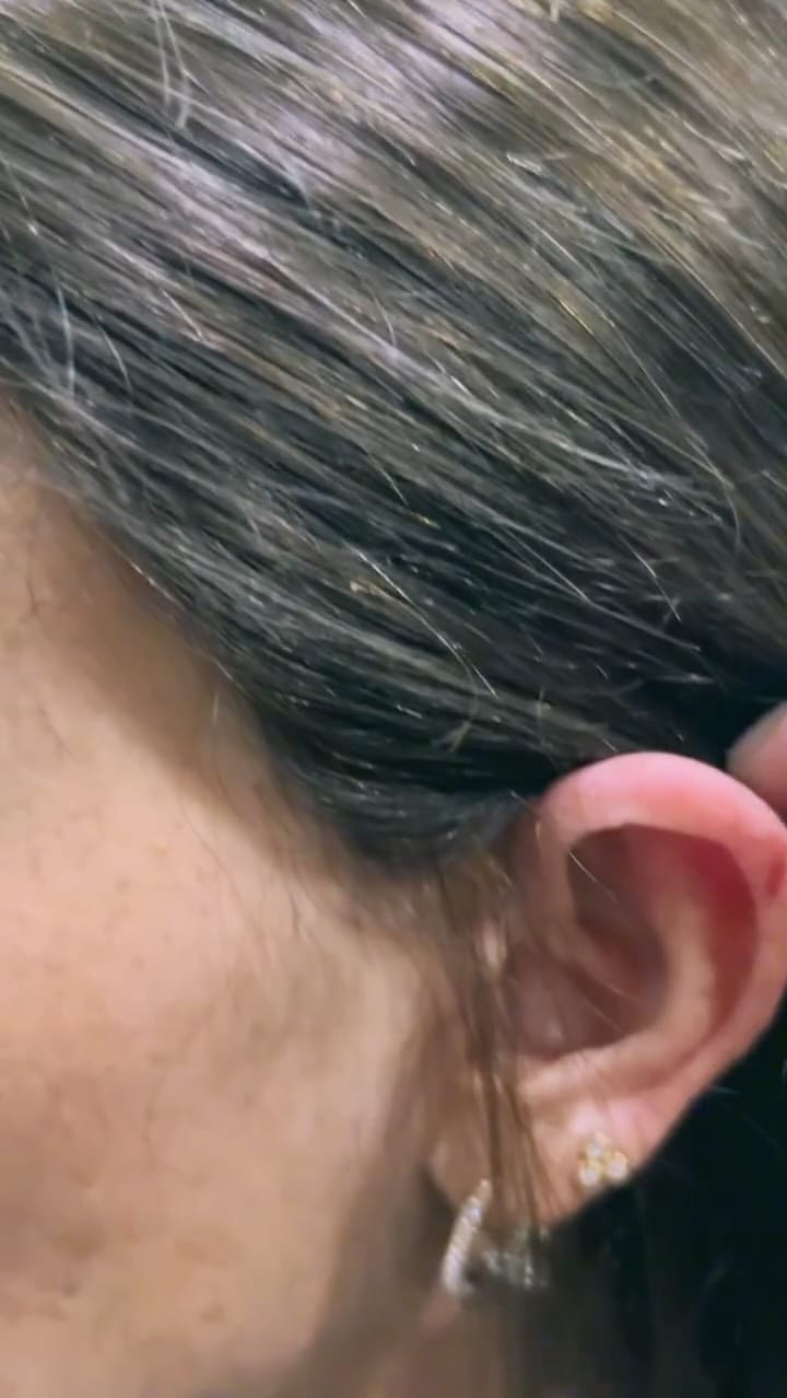 Post 7 by Nova Hair (By Ertaç ŞENSOY) on Instagram (video)