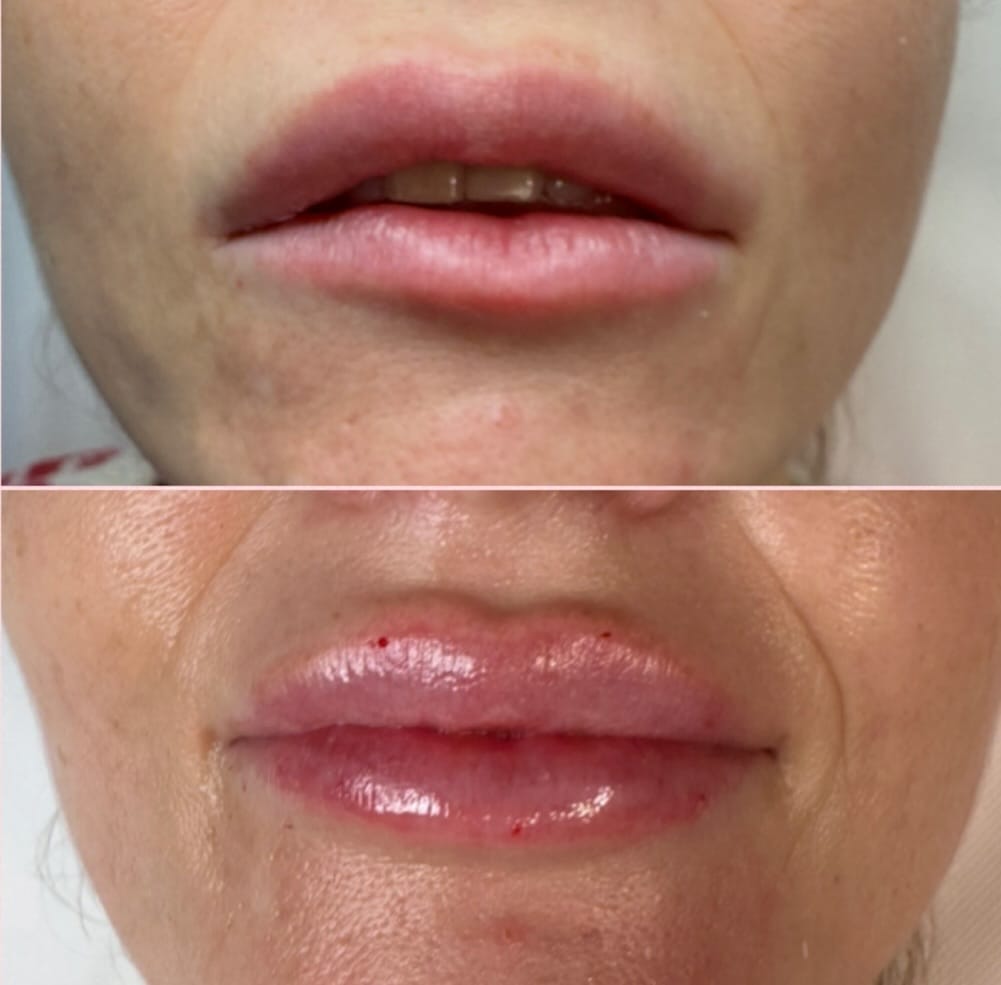 Post 2 by Medico estetico antiging | menopausa on Instagram (image)