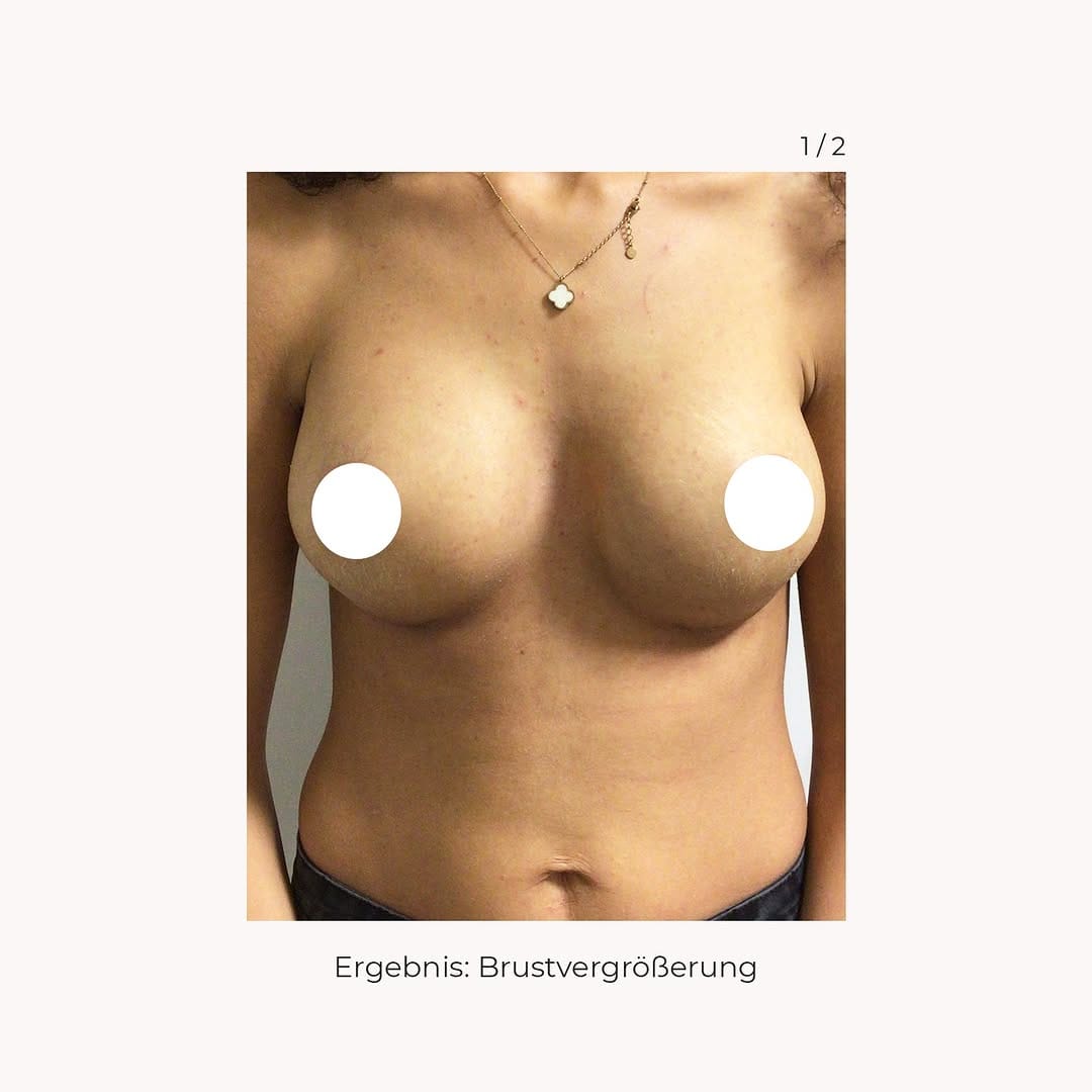 Post 1 by Kö-Klinik on Instagram (carousel)