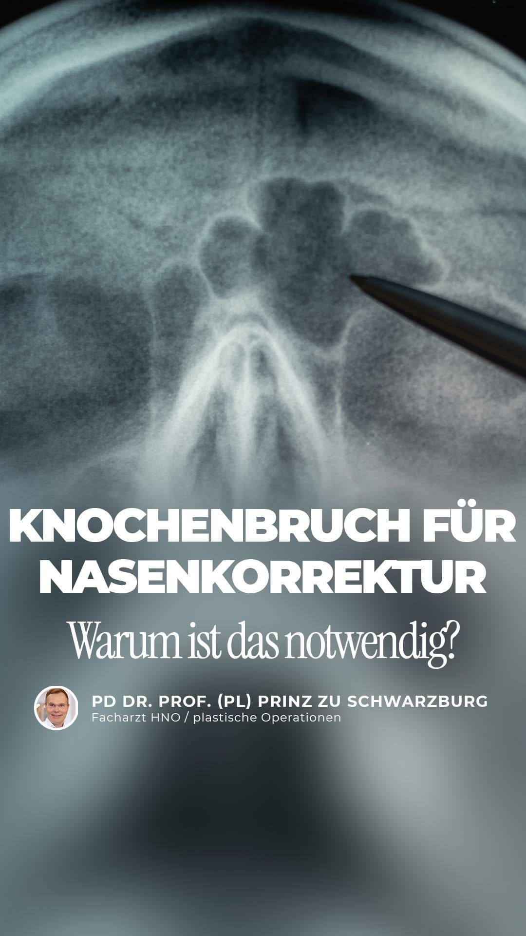Post 3 by Kö-Klinik on Instagram (video)
