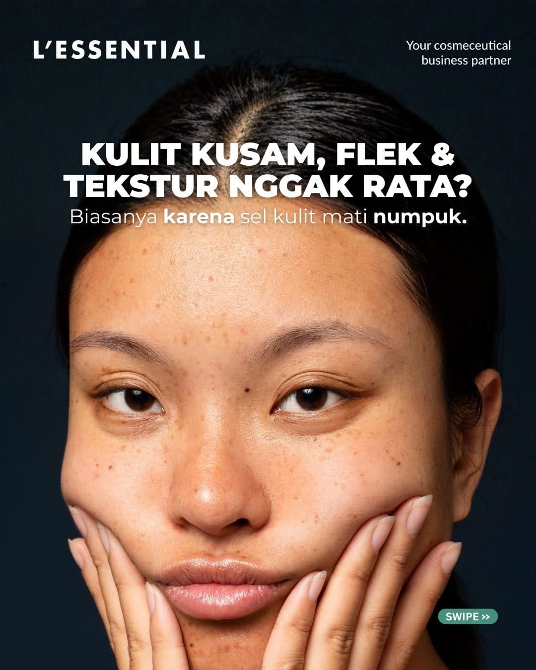Post 5 by MAKLON SKINCARE & KOSMETIK | PT. L’ESSENTIAL on Instagram (carousel)