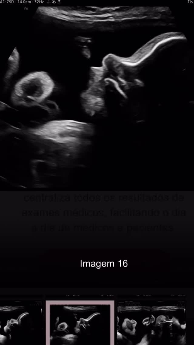 Post 1 by Caroline Scherer / Esteticista on Instagram (video)
