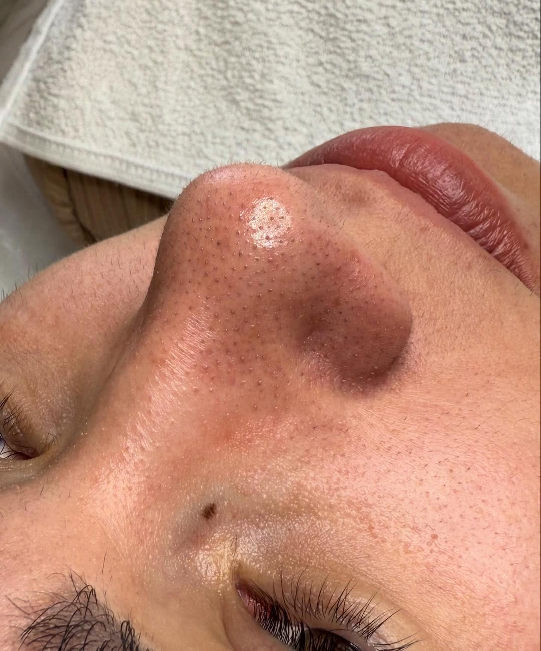 Post 3 by Caroline Scherer / Esteticista on Instagram (carousel)