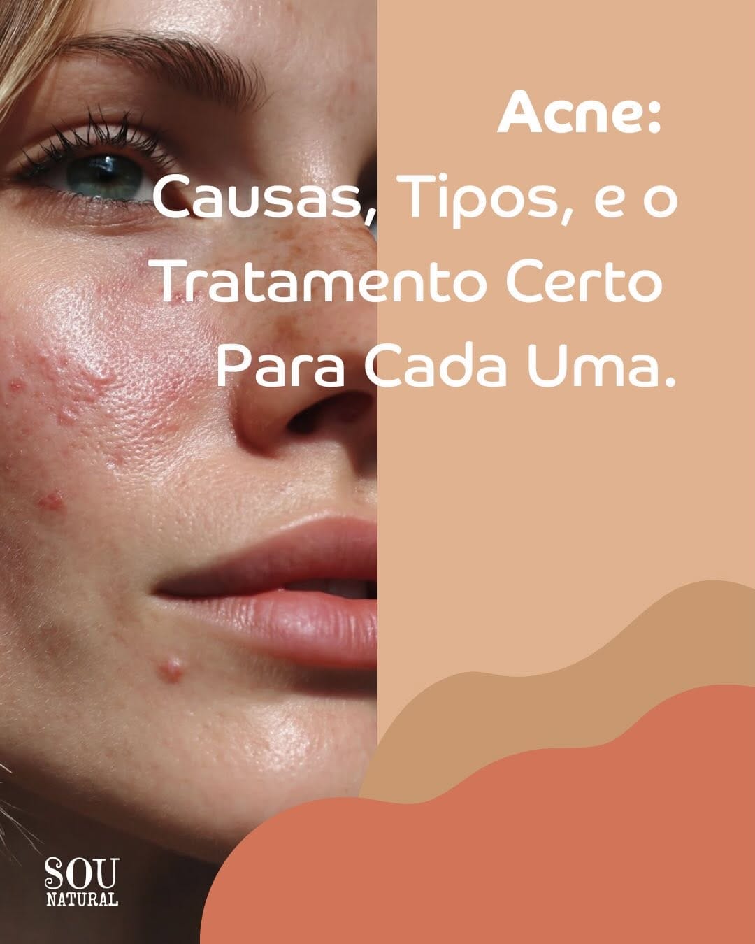 Post 1 by SOU NATURAL on Instagram (carousel)