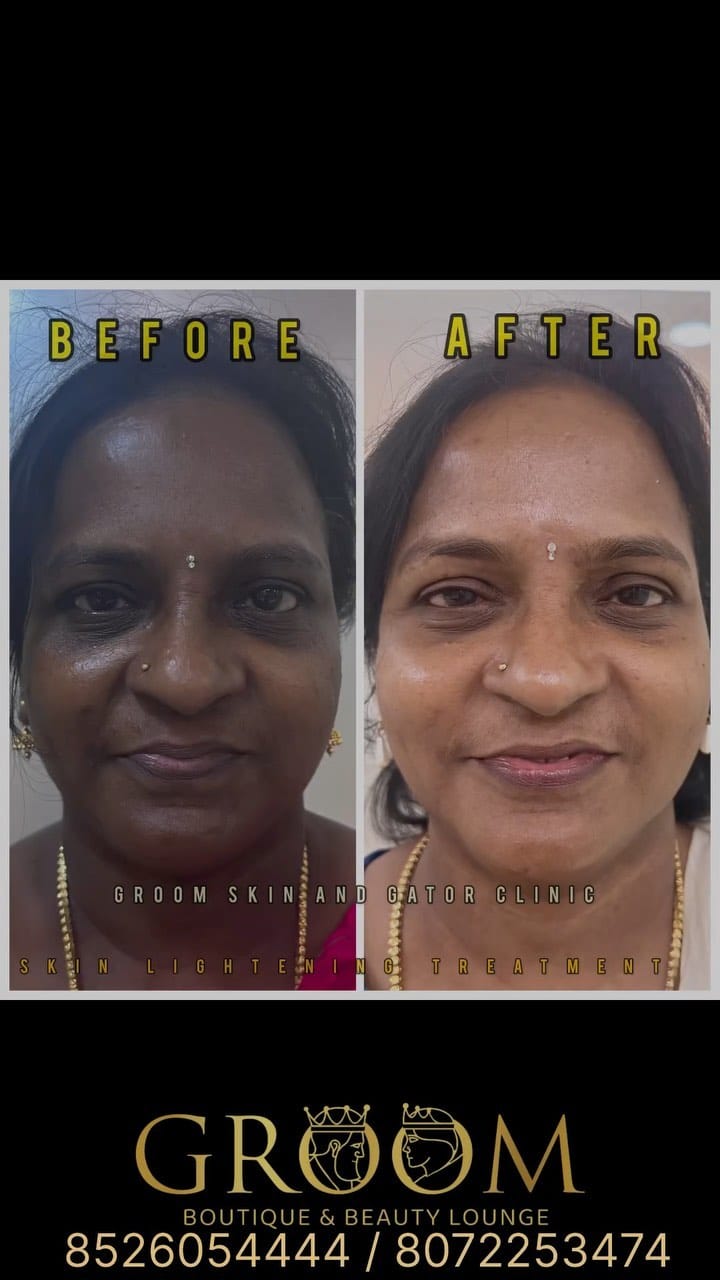 Post 9 by Groom Skin & Hair Clinic on Instagram (video)