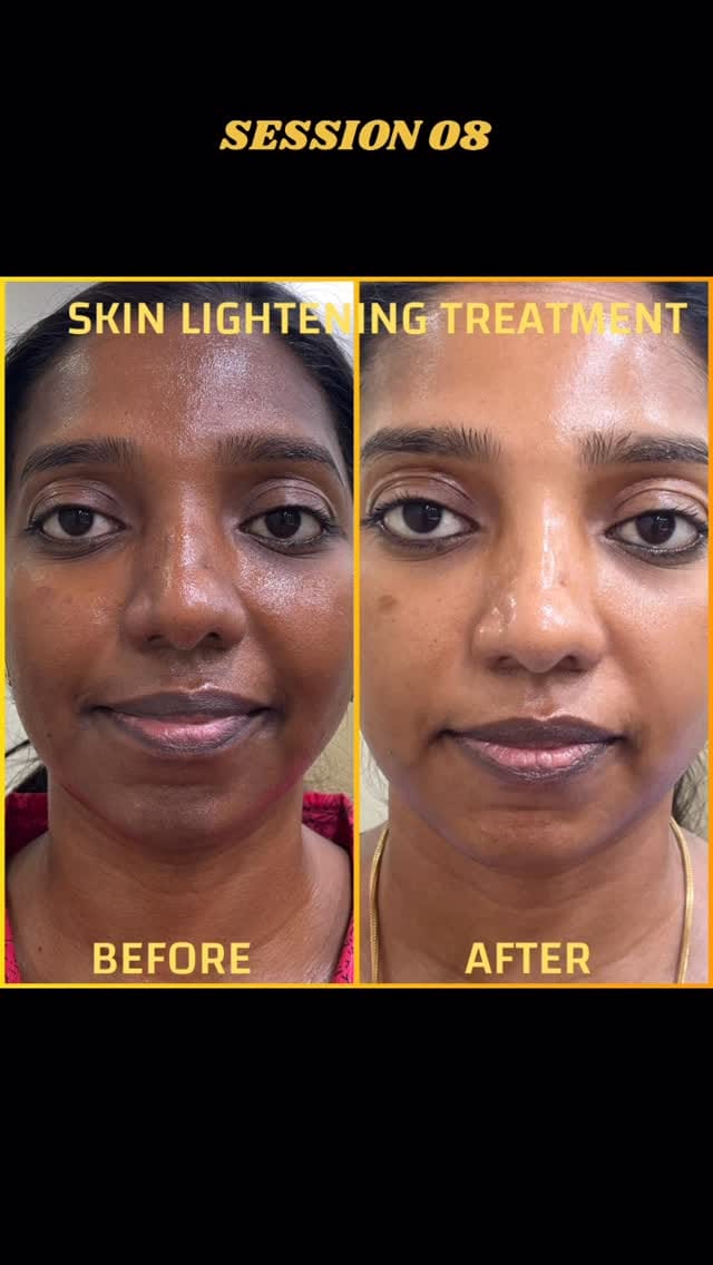 Post 1 by Groom Skin & Hair Clinic on Instagram (video)