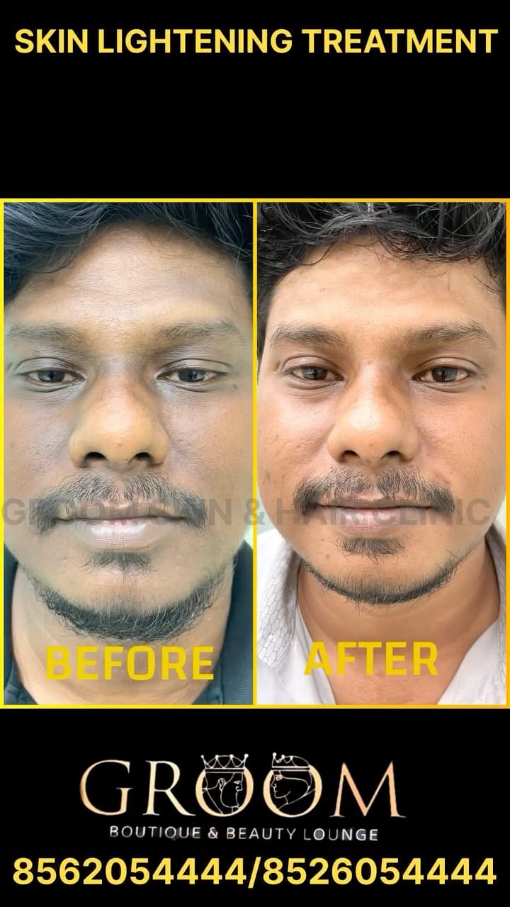 Post 6 by Groom Skin & Hair Clinic on Instagram (video)