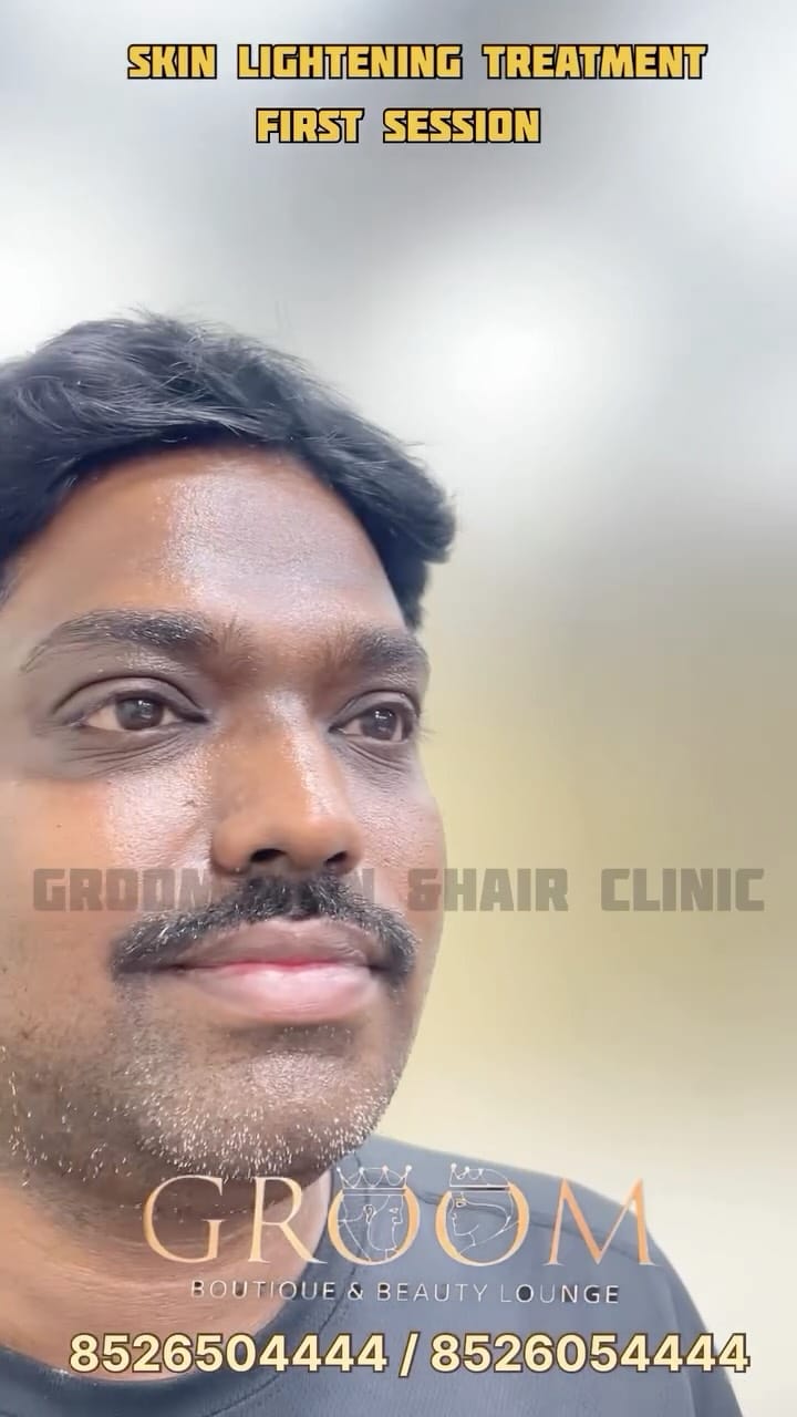 Post 7 by Groom Skin & Hair Clinic on Instagram (video)