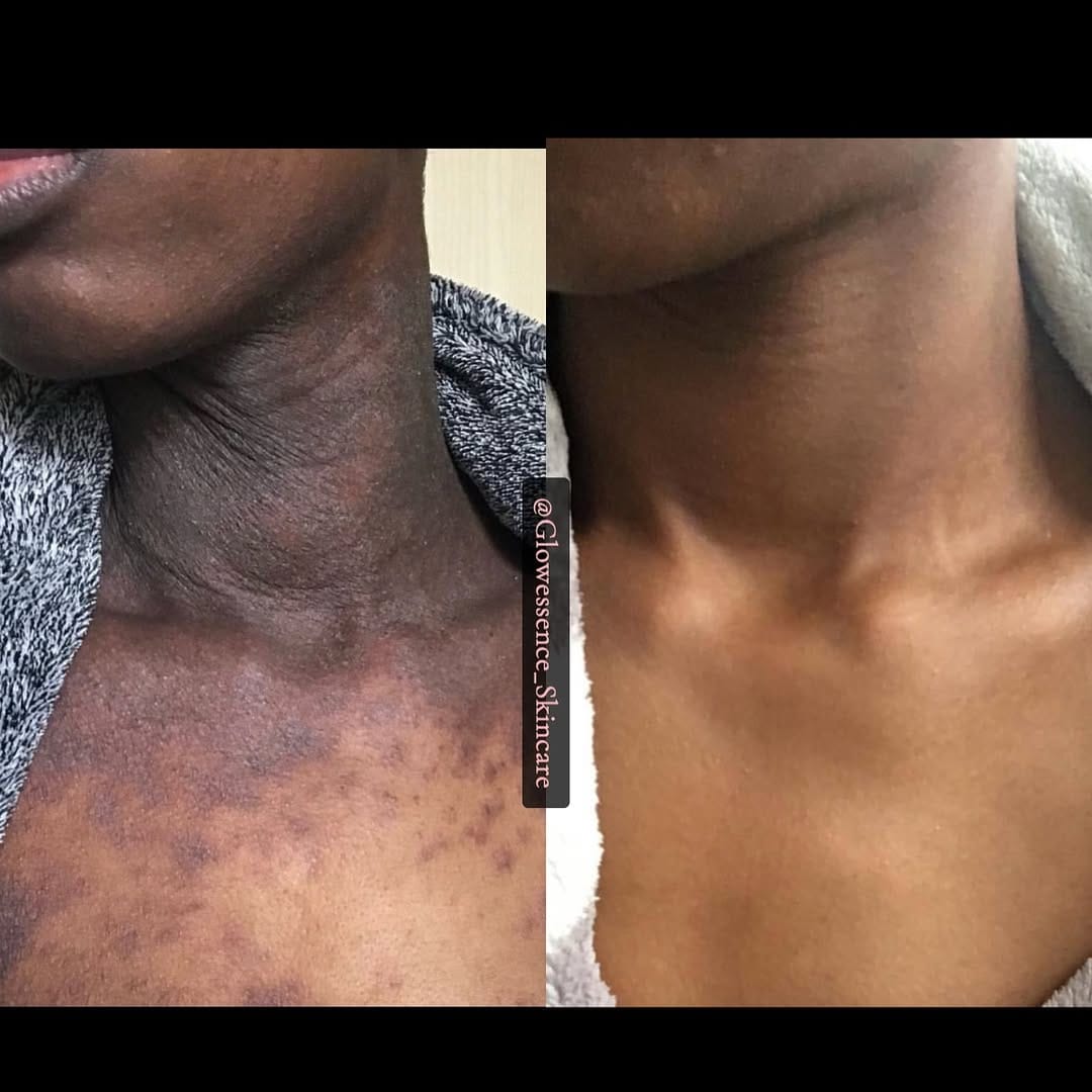 Post 10 by Glowessence Skincare on Instagram (carousel)