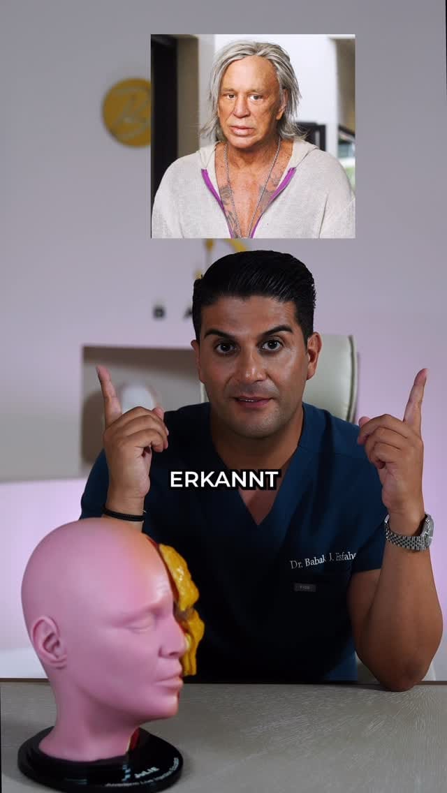 Post 4 by Dr. Babak J. Esfahani on Instagram (video)