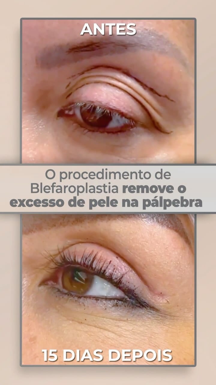 Post 10 by Dermatologia Estética on Instagram (video)