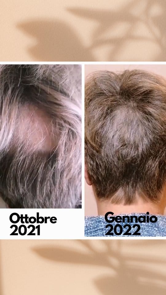Post 10 by Benessere con oli essenziali puri. Ex odontoiatra al tuo fianco on Instagram (video)