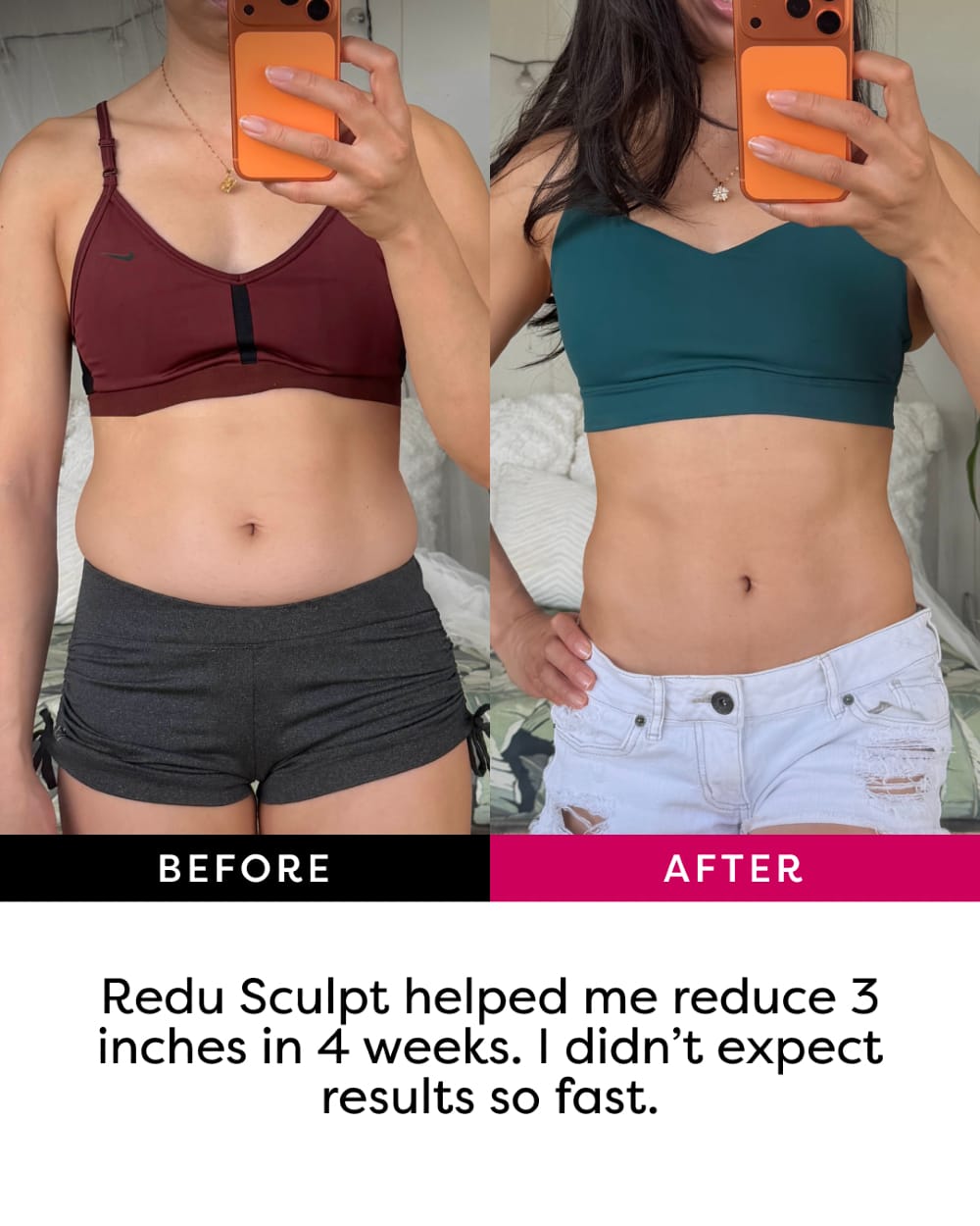 Post 3 by Redu Sculpt | Body Sculptor | Vacuum Therapy on Instagram (image)