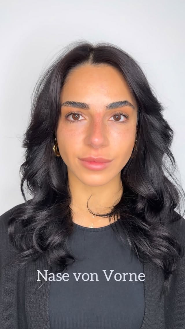Post 4 by Berybeauty Aesthetics® - YOUR BEAUTY & FILLER EXPERTS on Instagram (video)