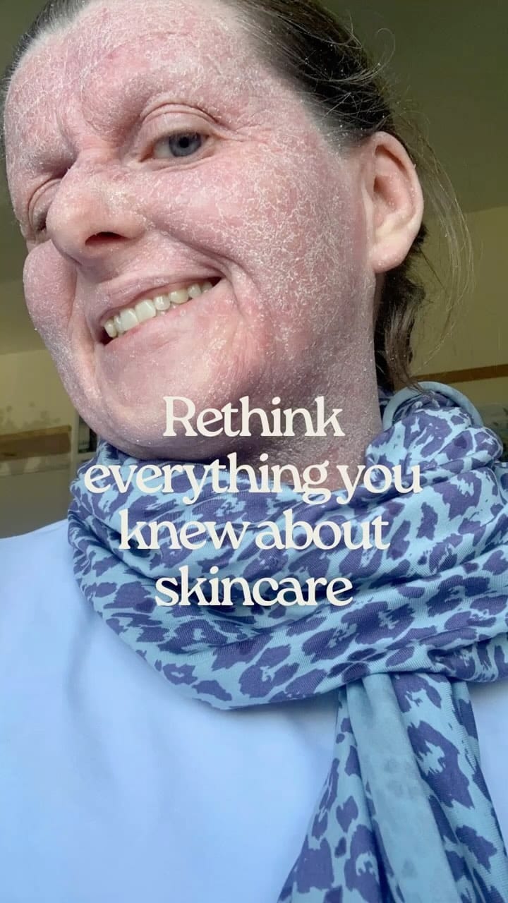 Post 8 by Whatallergy.com on Instagram (video)