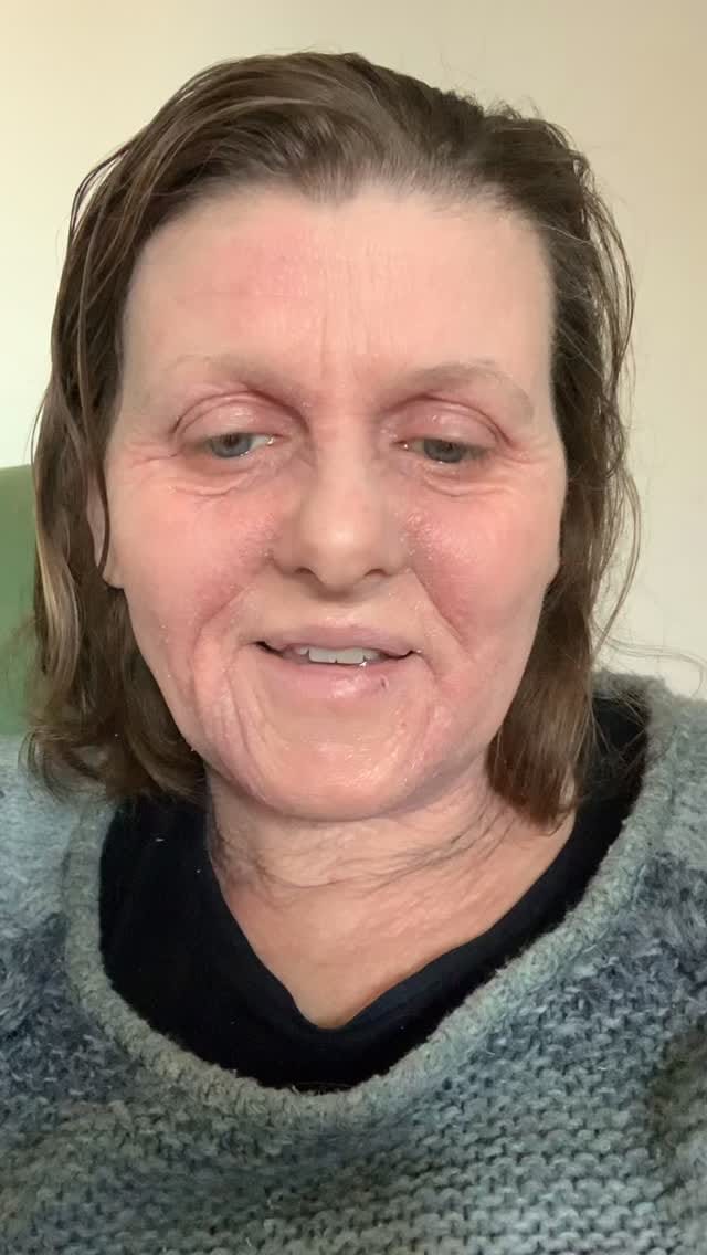 Post 2 by Whatallergy.com on Instagram (video)