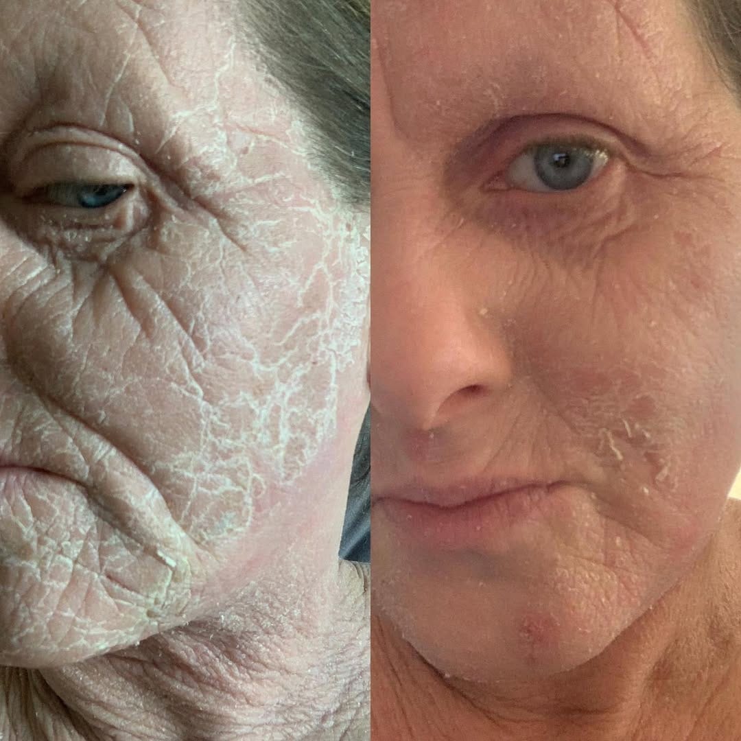 Post 9 by Whatallergy.com on Instagram (image)