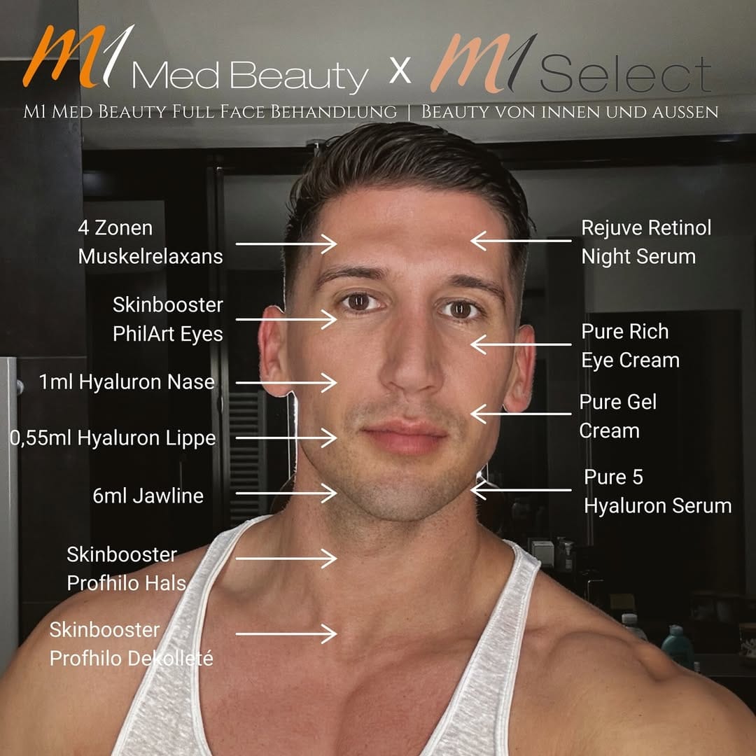 Post 1 by M1 SELECT on Instagram (image)