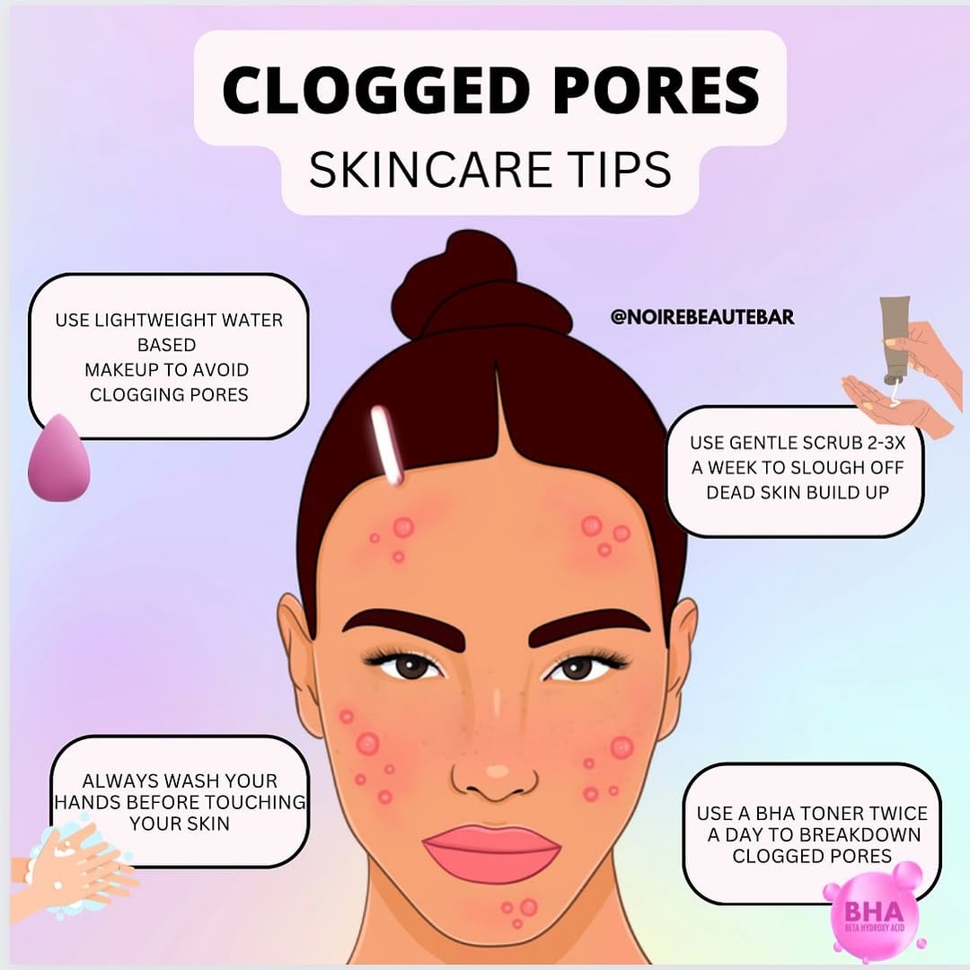 Post 4 by NOIRE BEAUTÉ ® on Instagram (image)