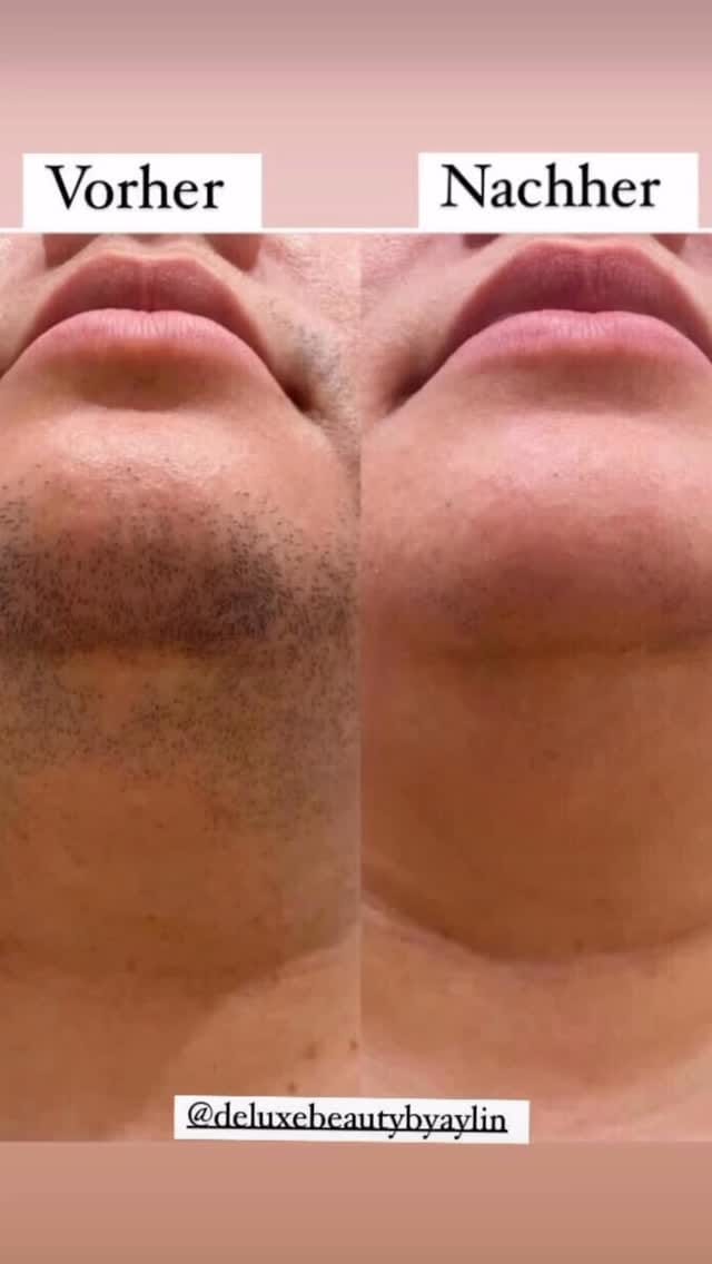Post 6 by DÉLUXE BEAUTY By Aylin on Instagram (video)