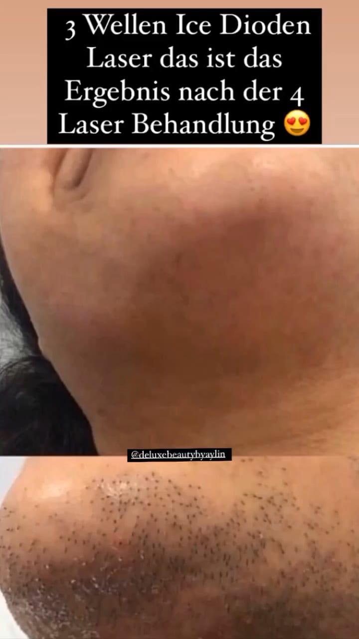 Post 4 by DÉLUXE BEAUTY By Aylin on Instagram (video)