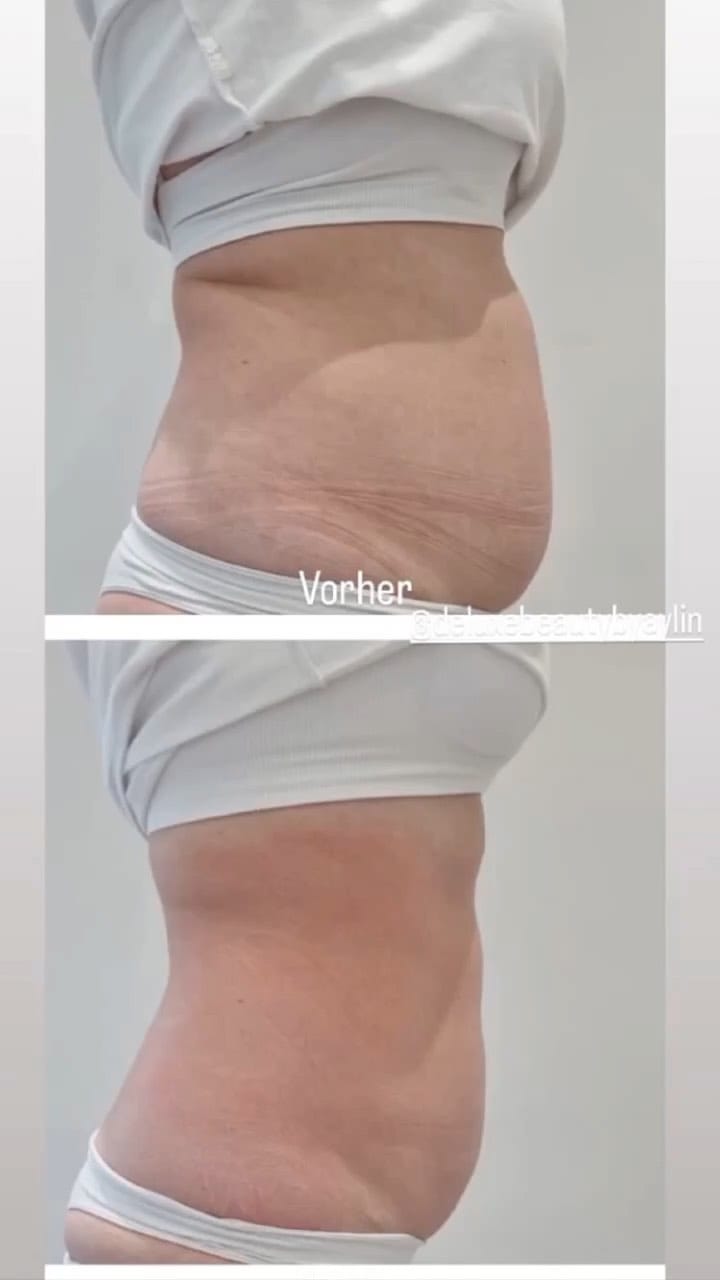 Post 3 by DÉLUXE BEAUTY By Aylin on Instagram (video)
