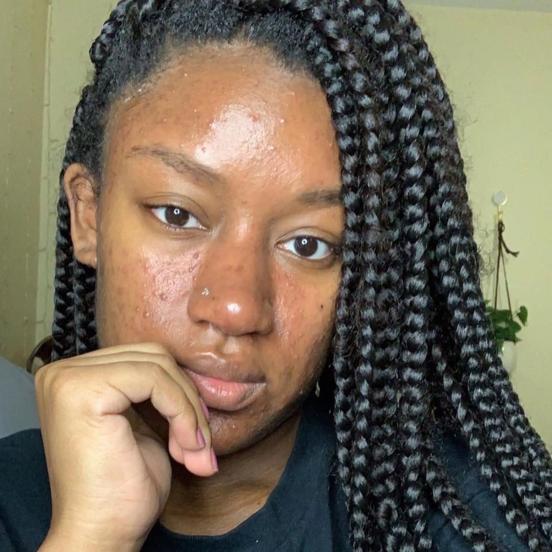 Post 10 by NOLA SKINSENTIALS on Instagram (carousel)