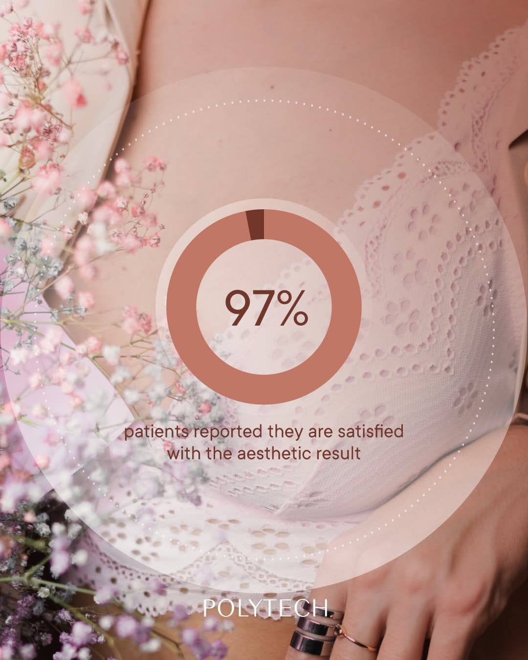 Post 1 by POLYTECH Breast Implants on Instagram (carousel)
