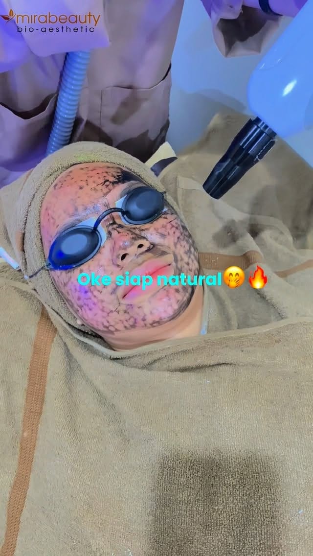 Post 5 by Mirabeauty Clinic Official on Instagram (video)