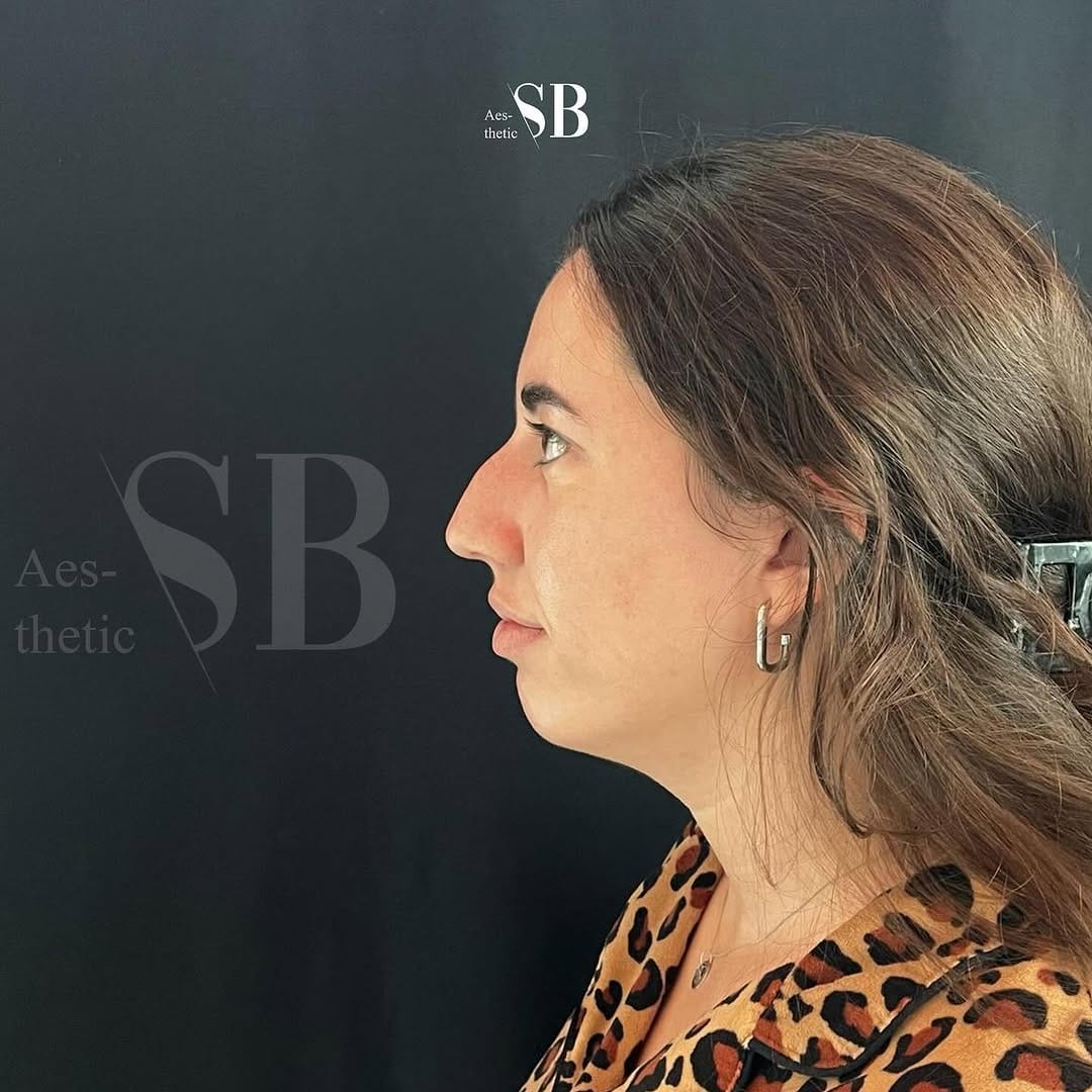 Post 3 by SB AESTHETİC on Instagram (carousel)