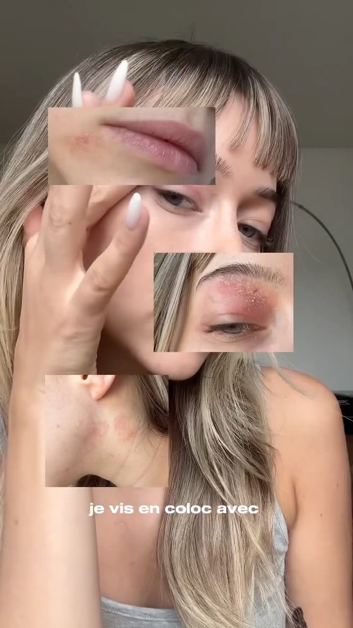 Post 10 by Blue Skincare on Instagram (video)