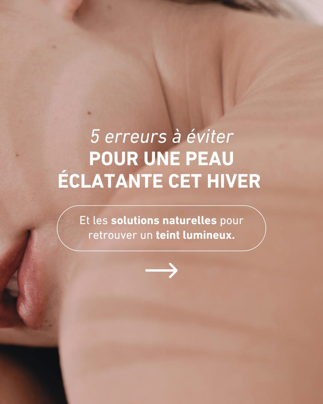 Post 3 by L'Officine Immortelle · Herboristerie Française on Instagram (carousel)