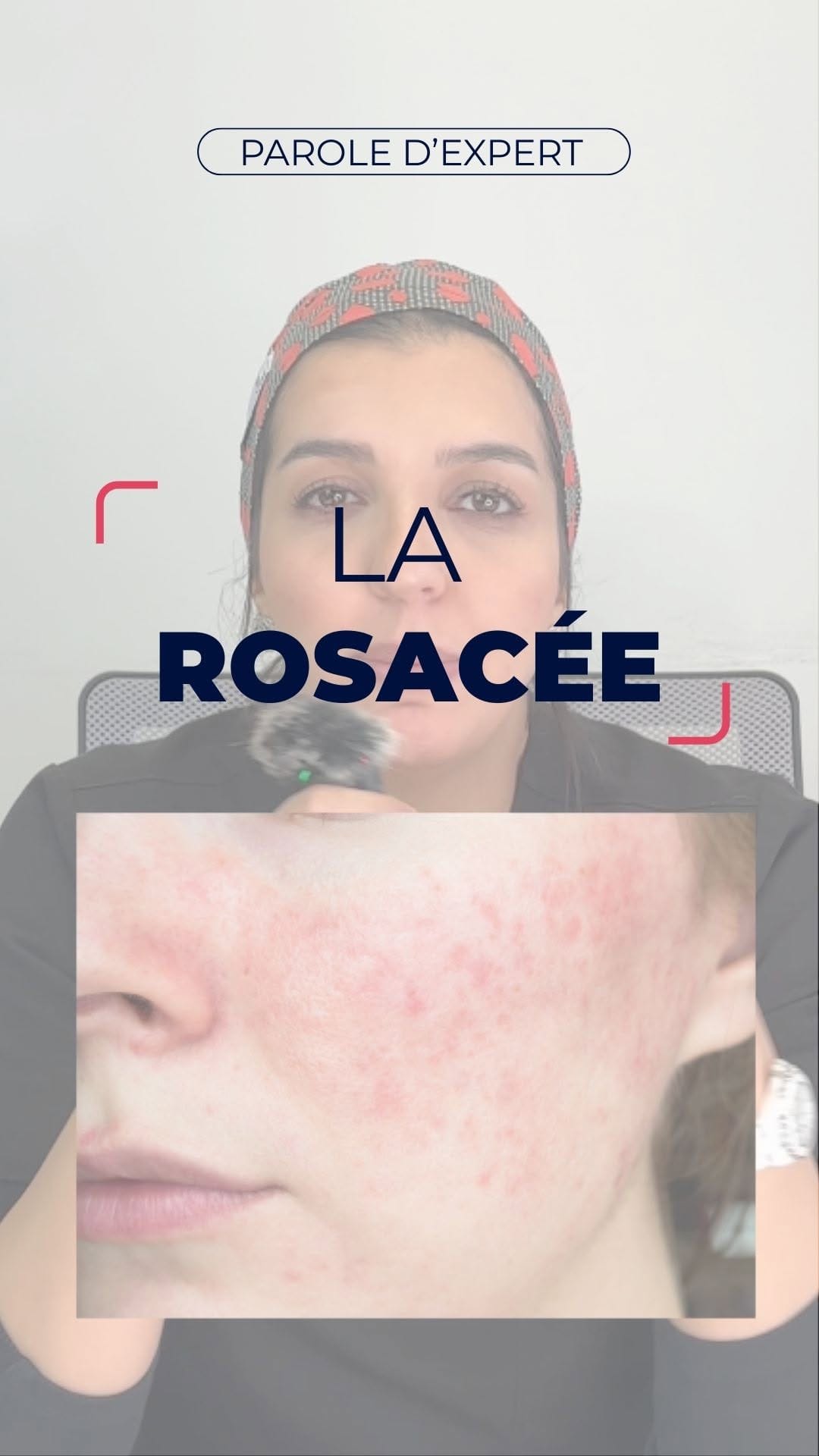 Post 8 by ISISPHARMA Dermatologie on Instagram (video)