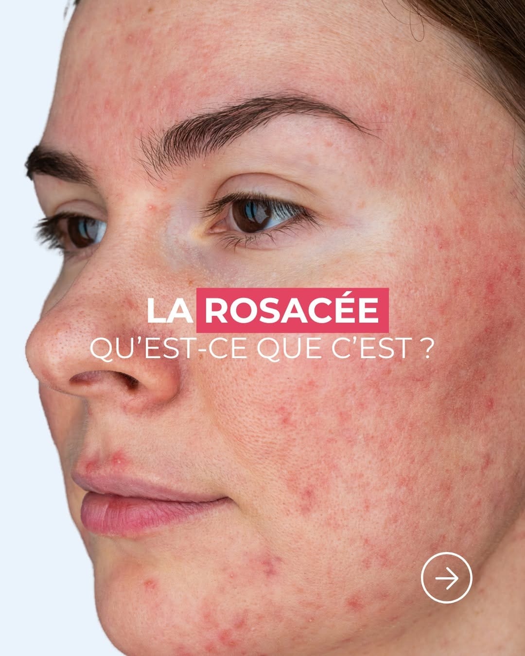 Post 10 by ISISPHARMA Dermatologie on Instagram (carousel)