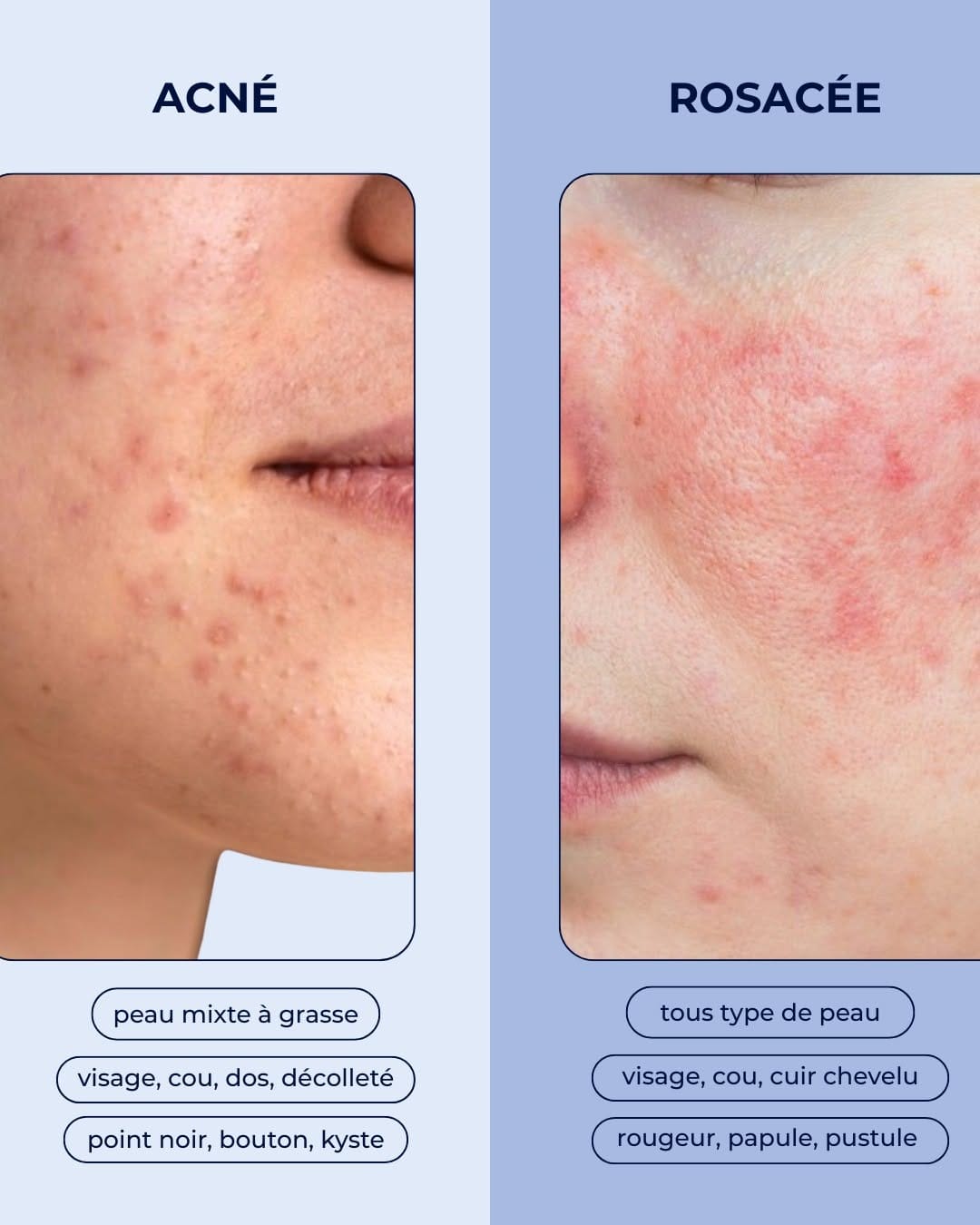 Post 7 by ISISPHARMA Dermatologie on Instagram (carousel)