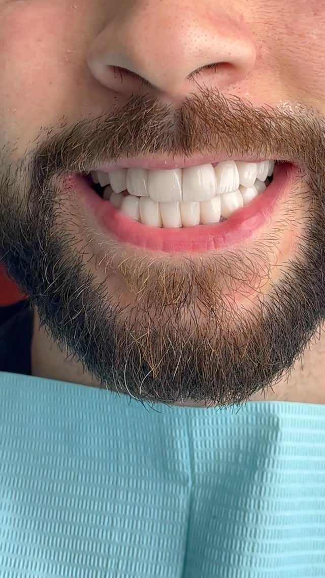 Post 3 by Facette dentaire à Dubai - Dentasmart.fr on Instagram (video)