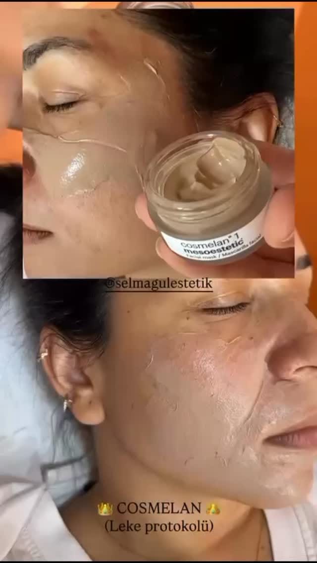 Post 10 by Selmagül Estetik 🌹  Güzellik Merkezi Eğitim Mentor on Instagram (video)